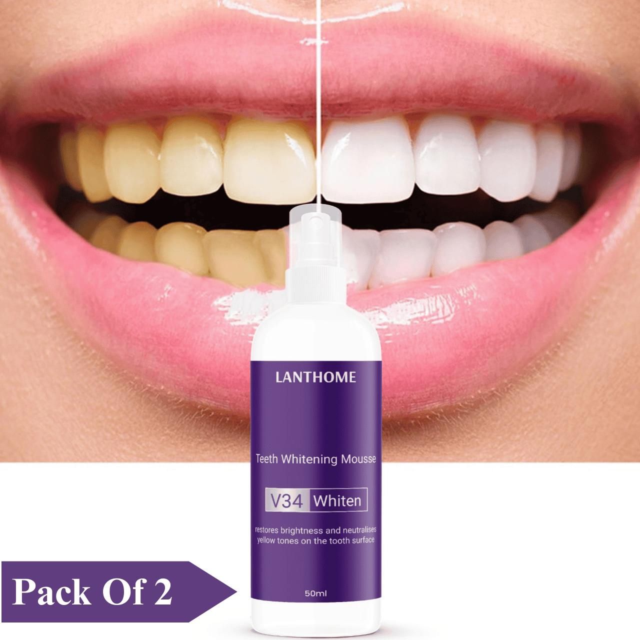 Lanthome Teeth Whitening Spray Mousse V34 Whiten 50ml (Pack Of 2)