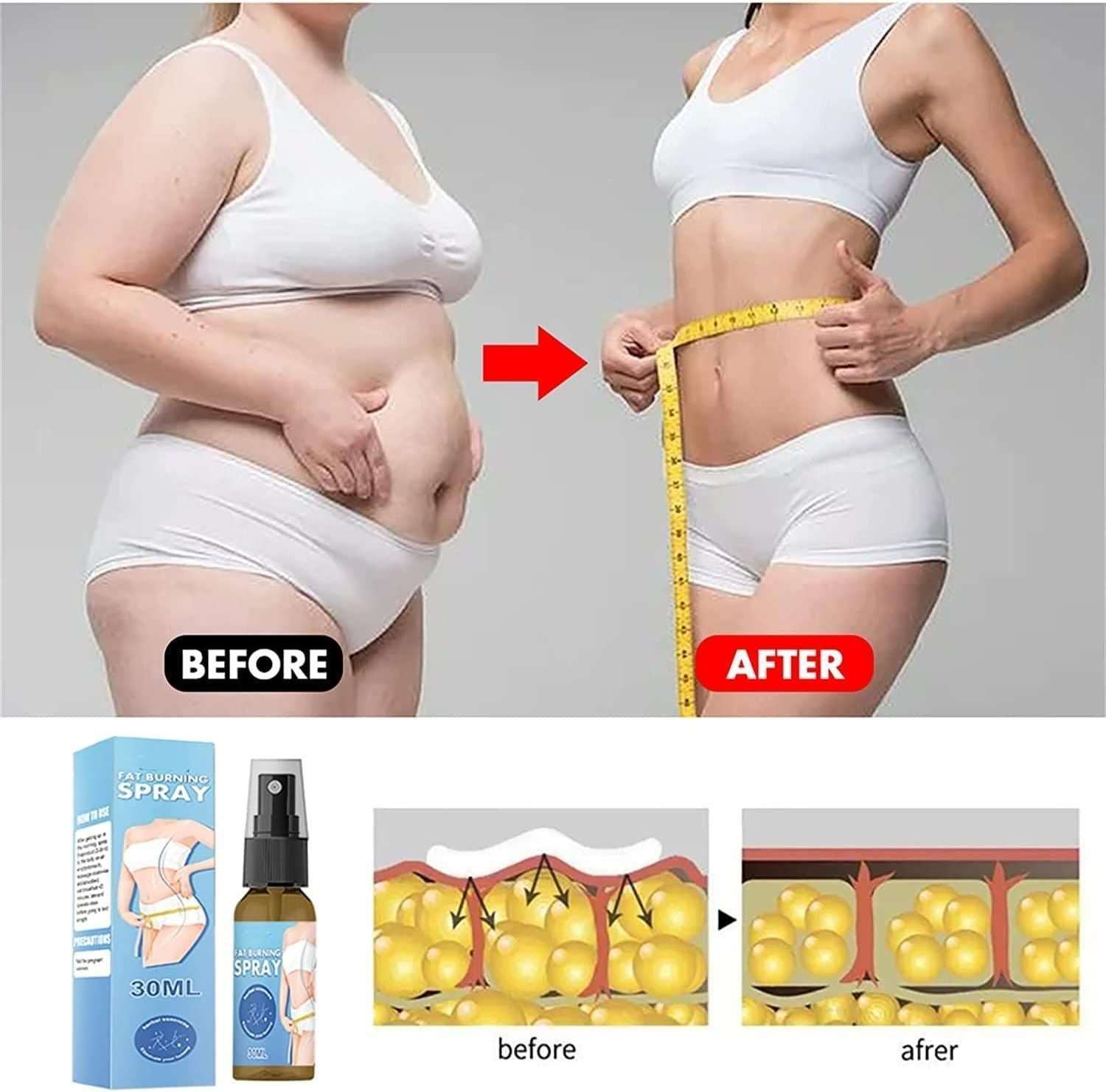 Fat Burner Slimming Spray 30 ml (Pack of 1)