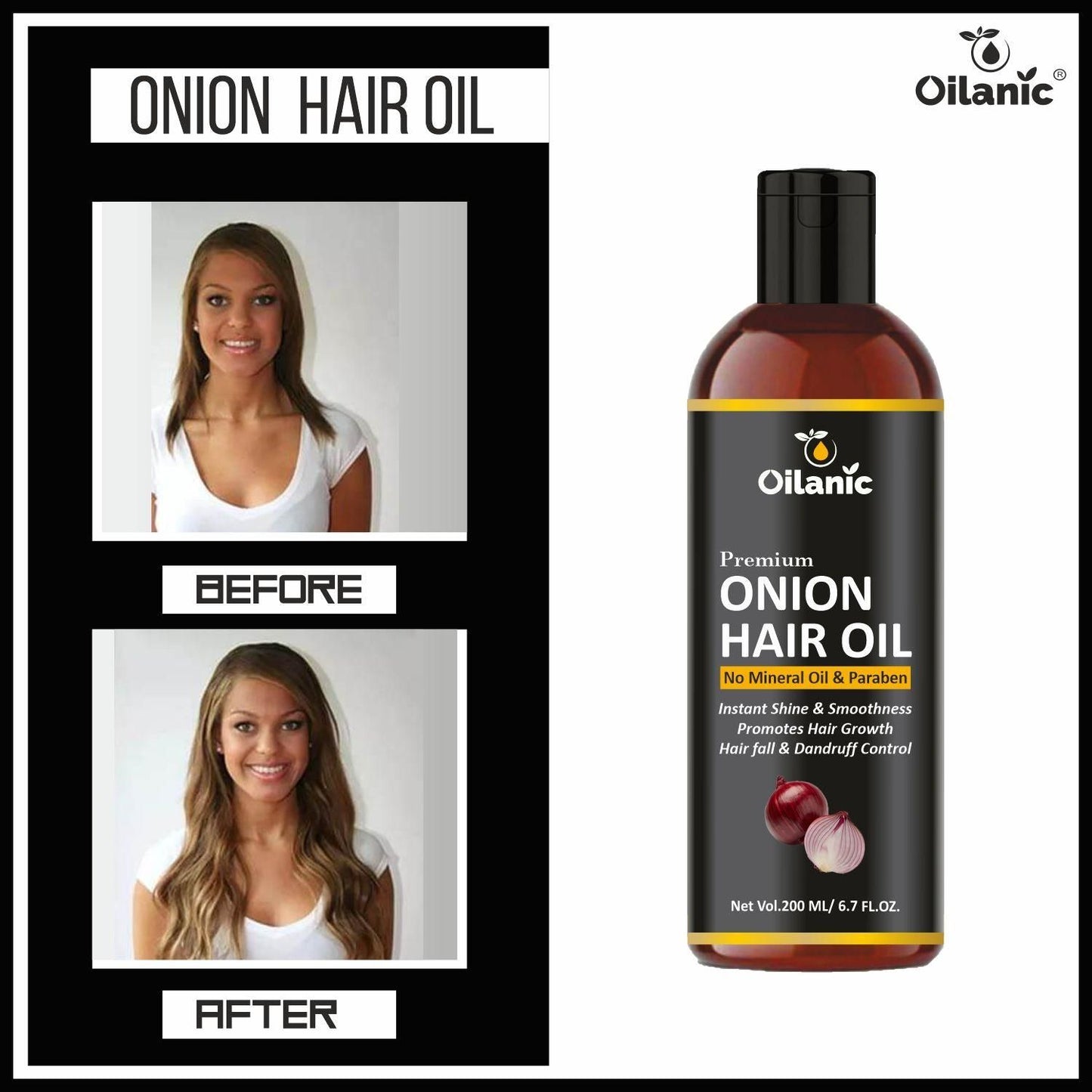 Oilanic Premium Onion Oil - For Healthy and Faster Hair Growth 200ml