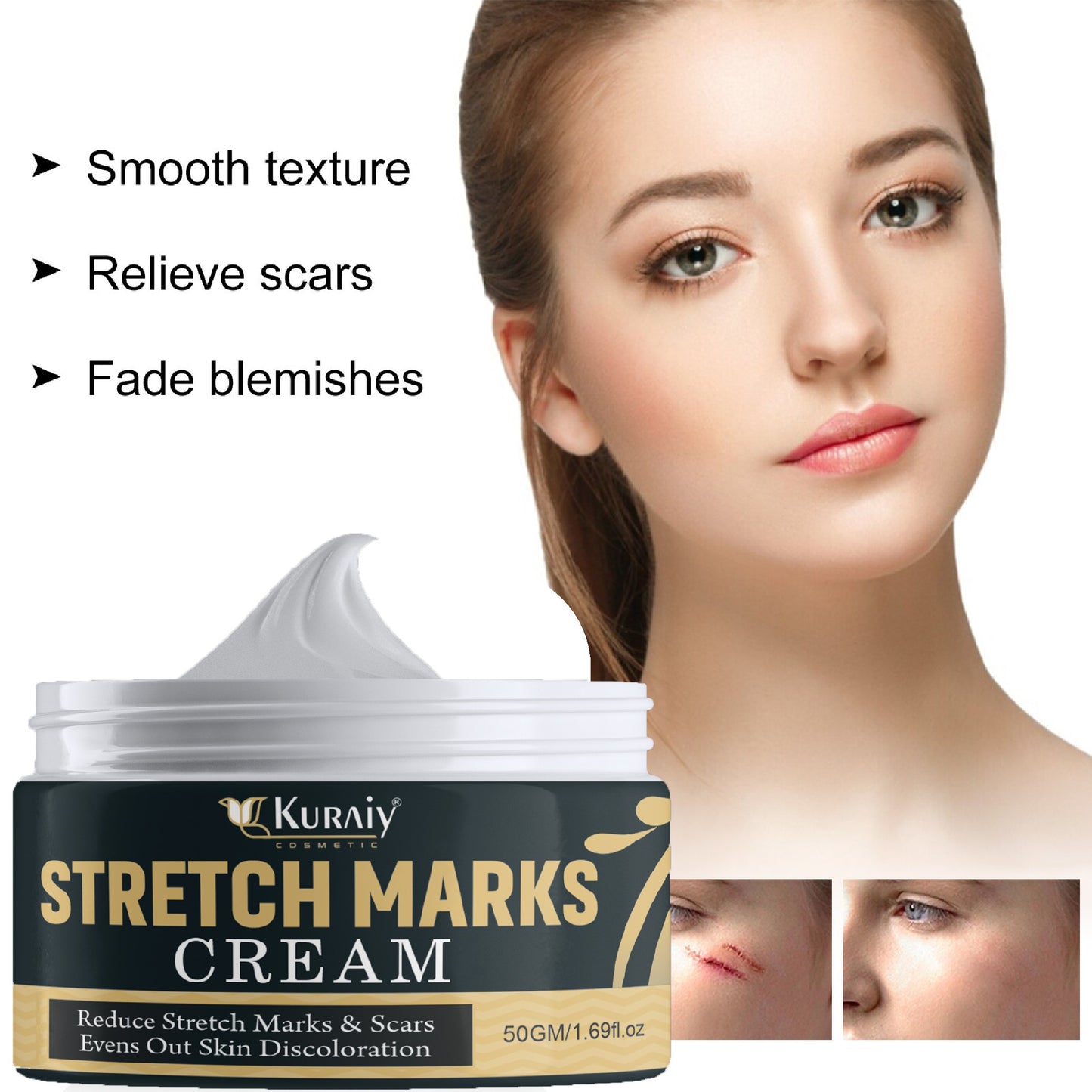 KURAIY Remove Pregnancy Scars Acne Cream Stretch Marks Treatment Maternity Repair Anti-Aging Anti-Winkles Firming Body Creams